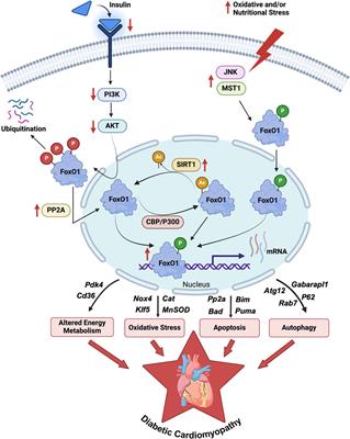 Forkhead box O1 transcription factor; a therapeutic target for diabetic cardiomyopathy